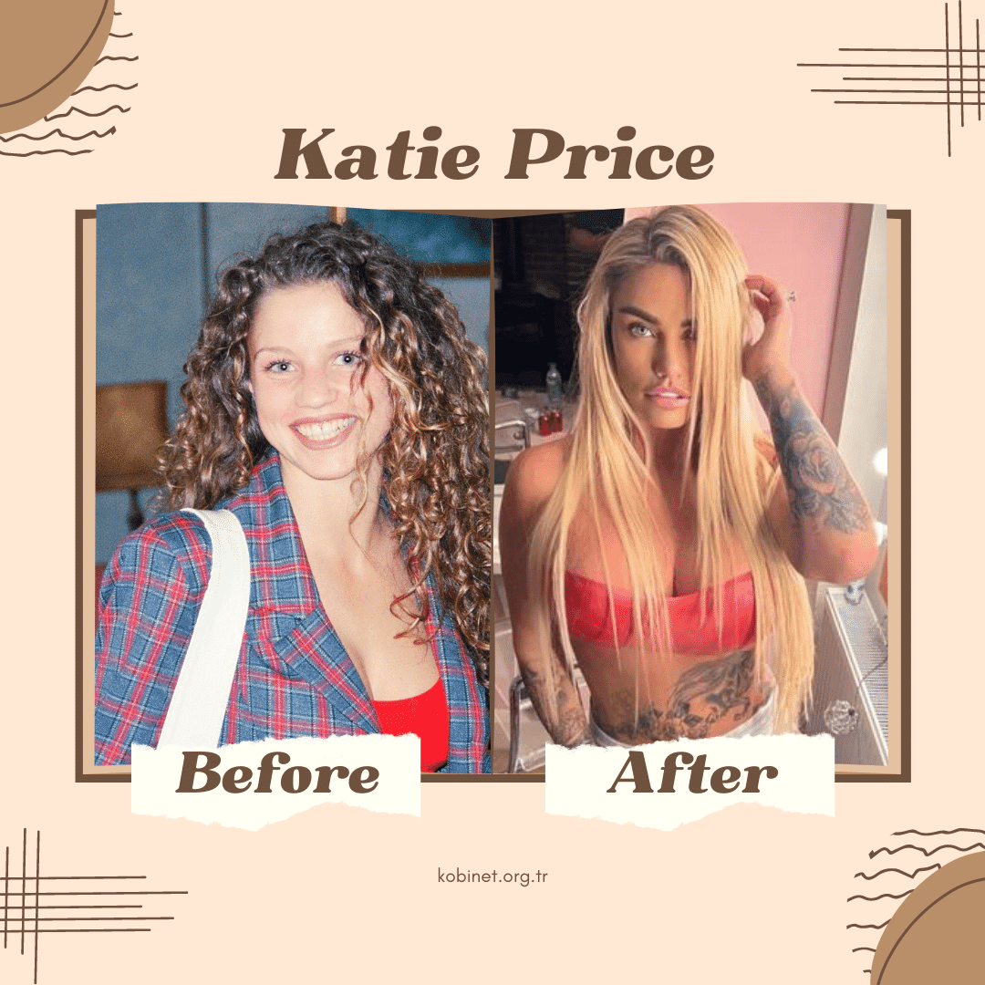 Katie Price before after