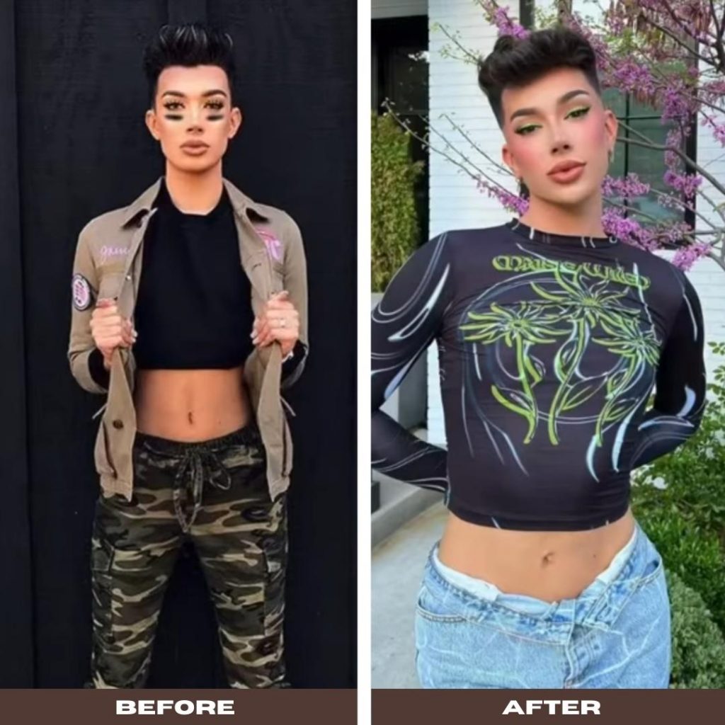 Did James Charles get a bbl?