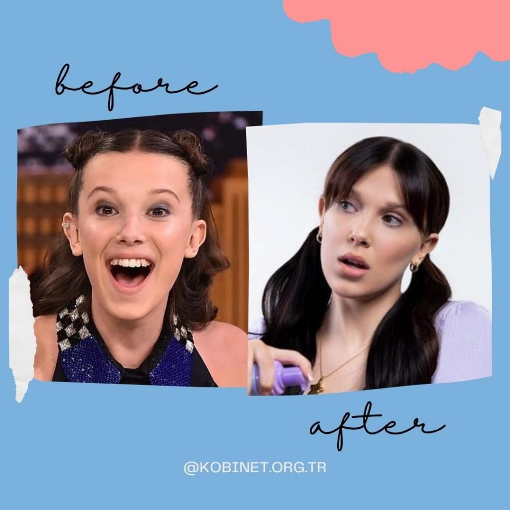 millie bobby brown before-after