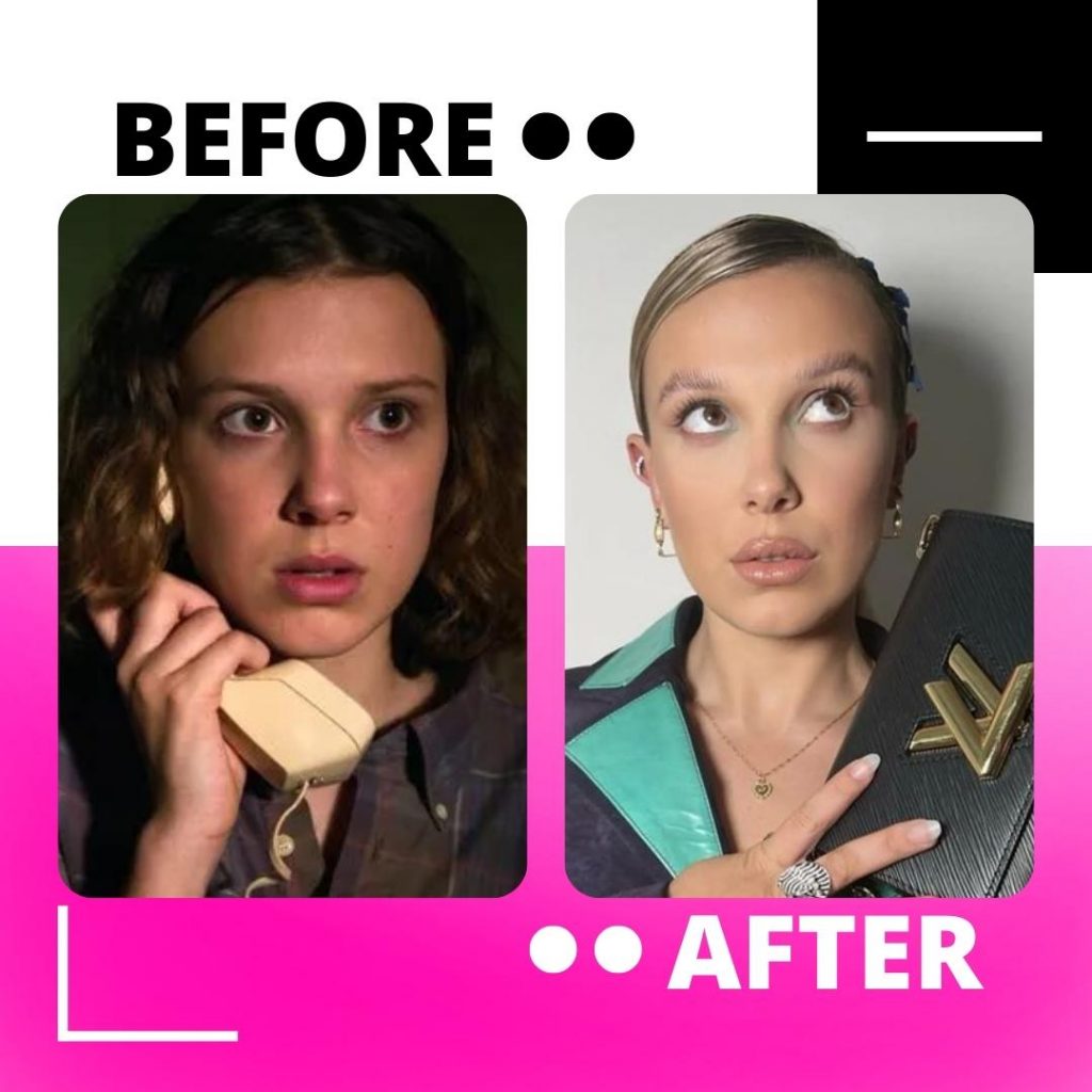 millie bobby brown before-after