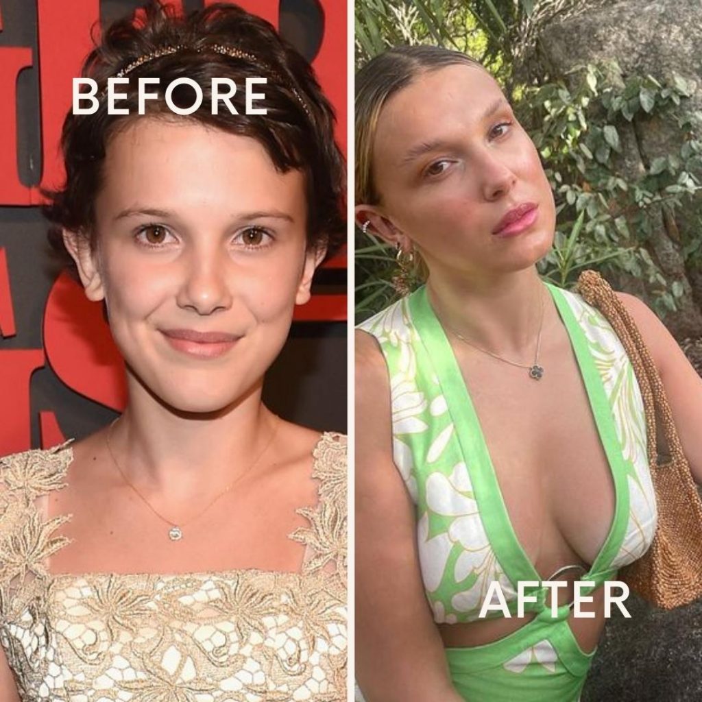 millie bobby brown before-after
