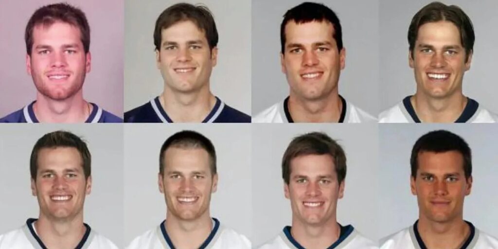 Tom Brady before after photos