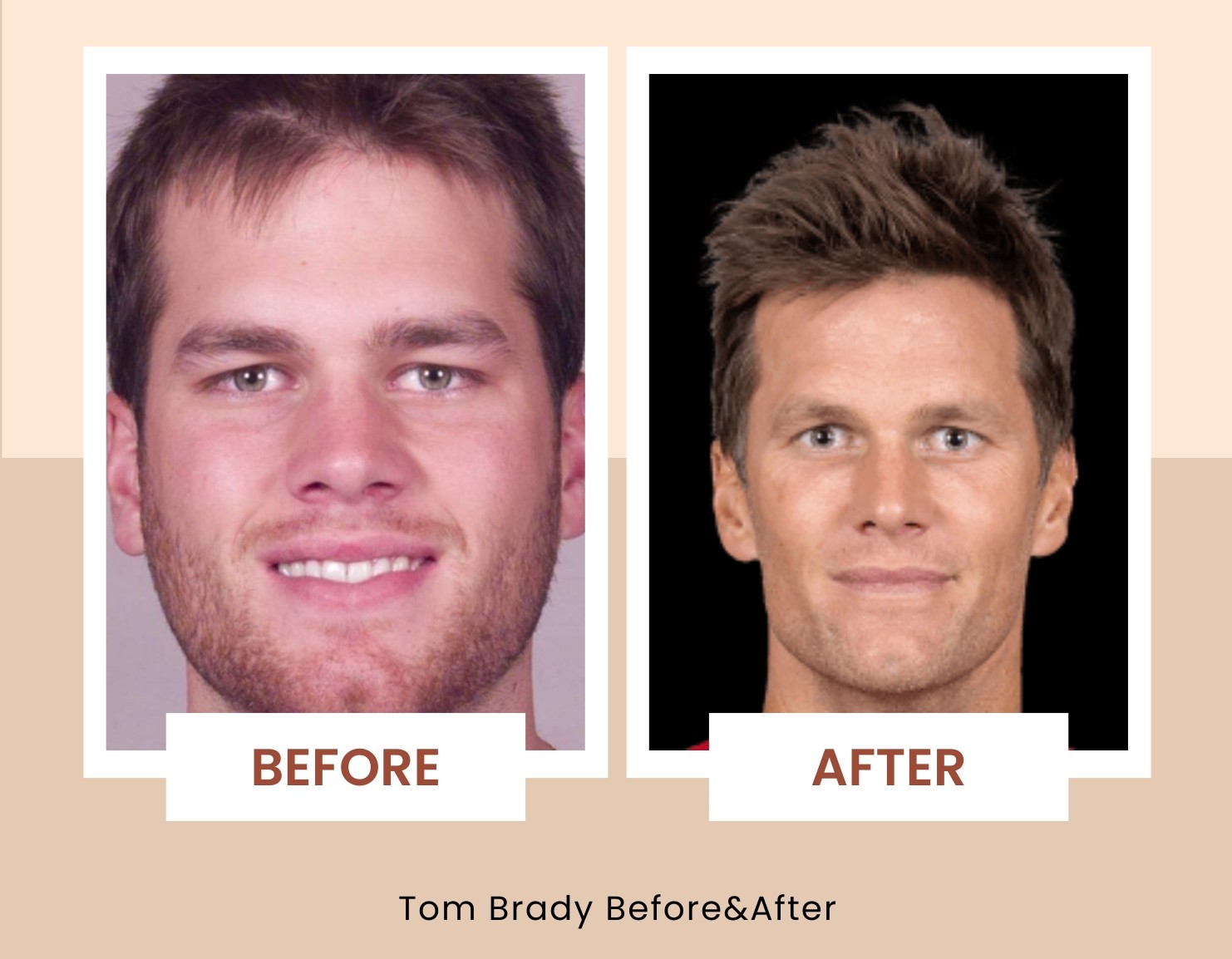 Tom Brady before after